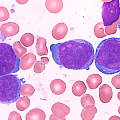 Wilmot Highlights Blood Cancer Research at National Meeting