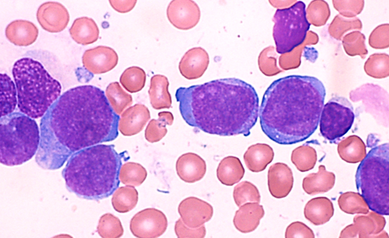 Wilmot Highlights Blood Cancer Research at National Meeting