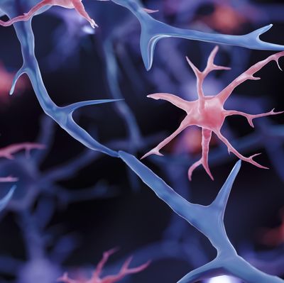 Brain Immune Cells May Drive More Damage in Females than Males with Alzheimer’s