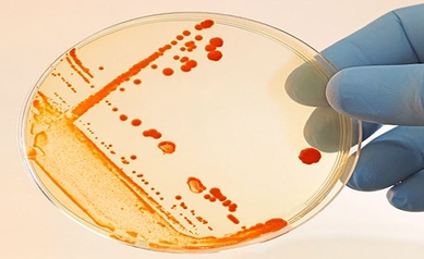Can Men Have Bacterial Vaginosis?