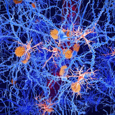 microglia_11zon