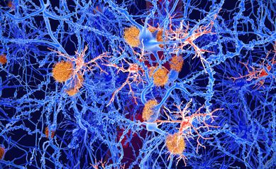 microglia_11zon