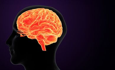 Why Are Strokes Increasing in Young Adults?