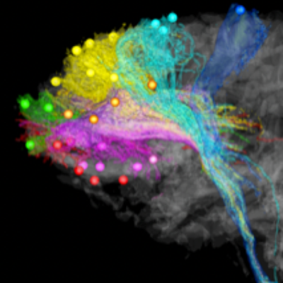 University of Rochester Neurobiologist Suzanne Haber Elected to National Academy of Medicine