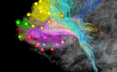 University of Rochester Neurobiologist Suzanne Haber Elected to National Academy of Medicine