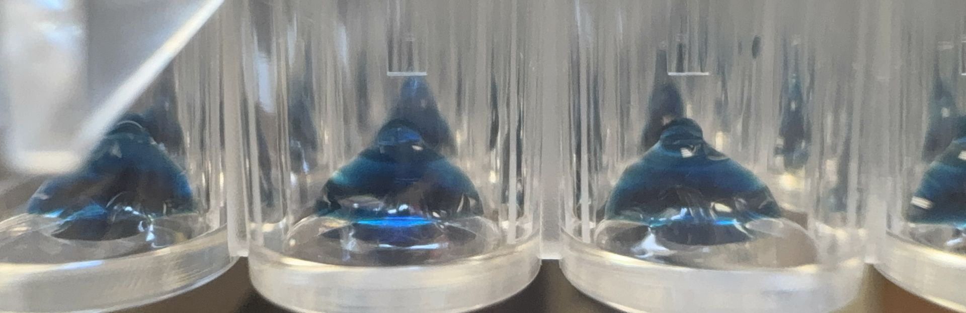 shigella samples