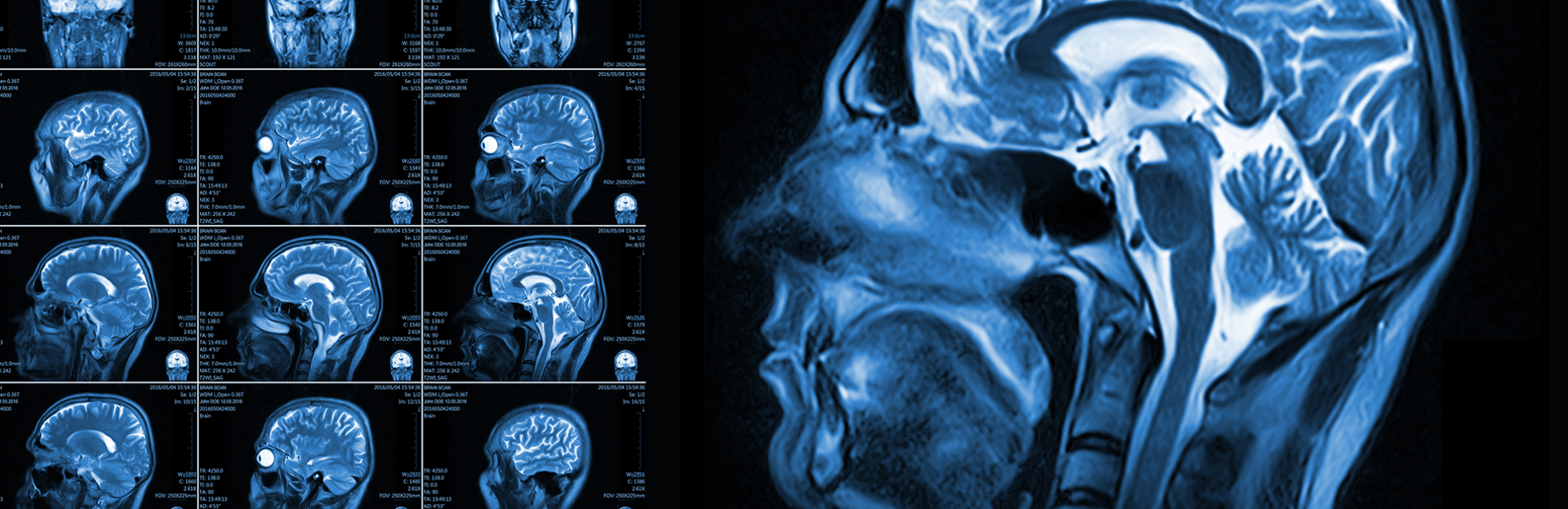 Brain MRI banner