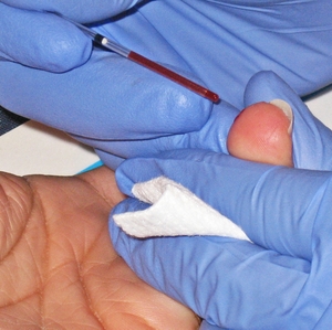  Blood draw from finger stick