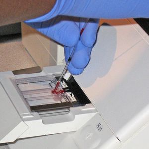Blood test 
